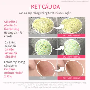 hince Kingsberry Vita Night Cream - Ảnh 9